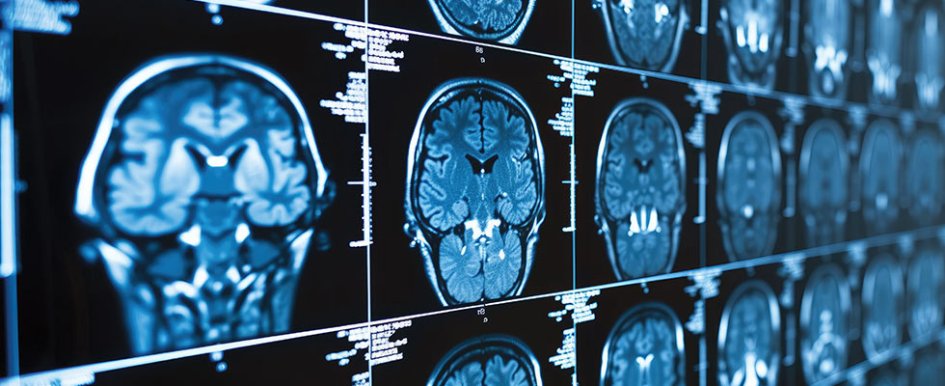 MRI scans